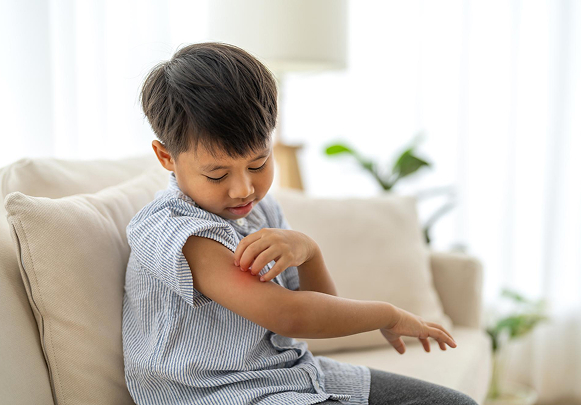 How to Protect Kids Skin (Ages 6–12) from Heat, Sweat & Rashes